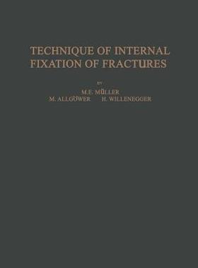 【预订】Technique of Internal Fixation of Fractures