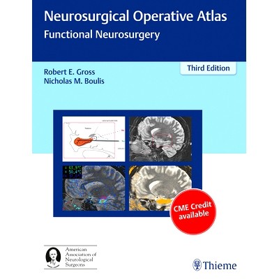 Functional Neurosurgery
