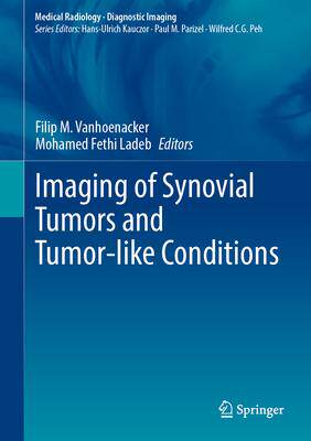 [预订]Imaging of Synovial Tumors and Tumor-Like Conditions 9783031336348