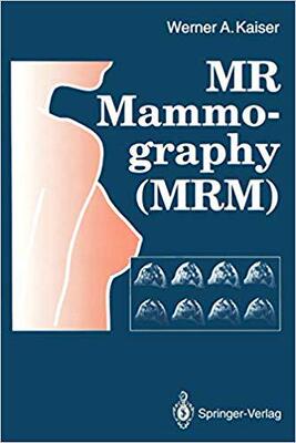 【预订】MR Mammography (MRM)