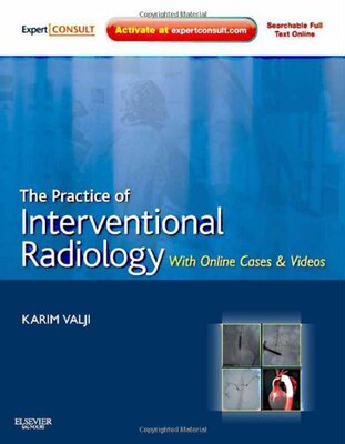 【预订】The Practice of Interventional Radiology, with online cases and video