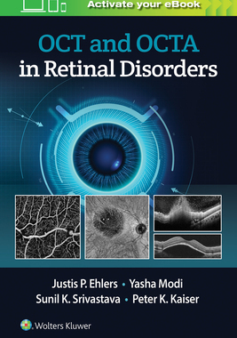 【预订】OCT and OCTA in Retinal Disorders