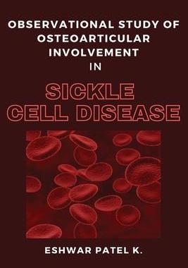 [预订]Observational Study of Osteoarticular Involvement in Sickle Cell Disease 9788266155634
