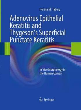 预订 Adenovirus Epithelial Keratitis and Thygeson’s Superficial Punctate Keratitis