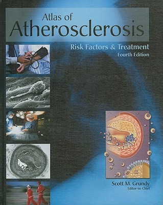 【预订】Atlas of Atherosclerosis and Metabolic Syndrome