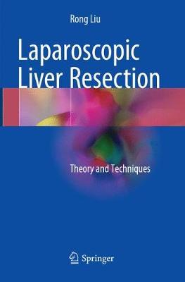 【预订】Laparoscopic Liver Resection
