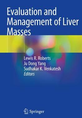 [预订]Evaluation and Management of Liver Masses 9783030467012