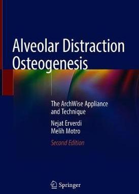 预订 Alveolar Distraction Osteogenesis