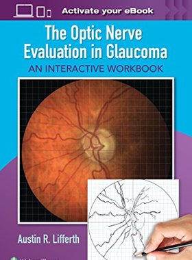 【预订】The Optic Nerve Evaluation in Glaucoma