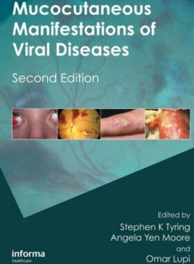 【预订】Mucocutaneous Manifestations of Viral Diseases