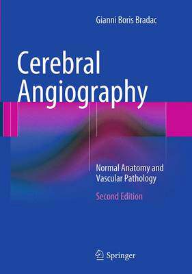 预订 Cerebral Angiography