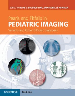【预订】Pearls and Pitfalls in Pediatric Imaging