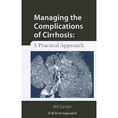 预订 Managing the Complications of Cirrhosis A Practical Approach 治疗肝硬化并发症：一种实用方法 9781556429576
