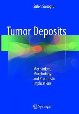 预订 Tumor Deposits