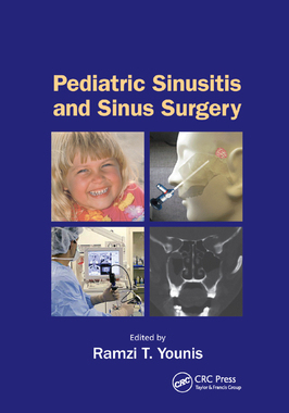 【预订】Pediatric Sinusitis and Sinus Surgery