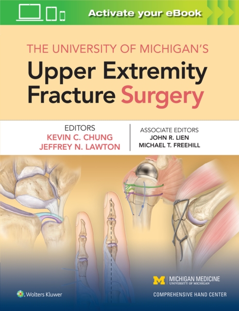 【预订】The University of Michigan’s Upper Extremity Fracture Surgery
