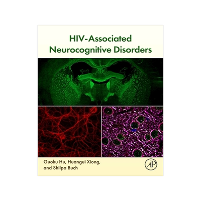 预订 Hiv-Associated Neurocognitive Disorders