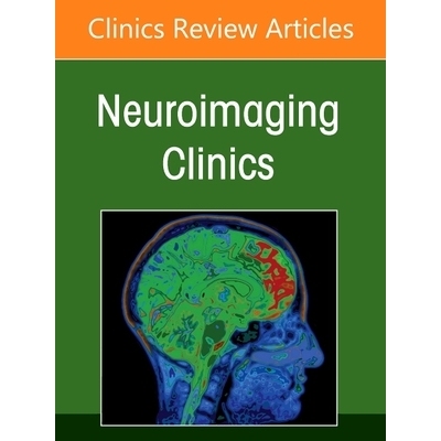 预订 Management and Treatment of Cerebral Aneurysms, An Issue of Neuroimaging Clinics of North America 脑动脉瘤的治疗与