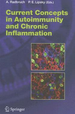 【预订】Current Concepts in Autoimmunity and Chronic Inflammation