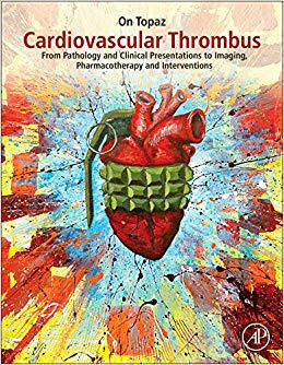 【预售】Cardiovascular Thrombus
