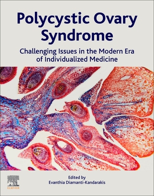 【预订】Polycystic Ovary Syndrome 9780128230459