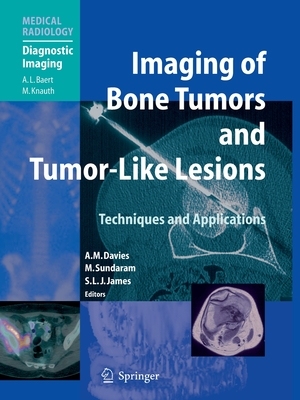 【预订】Imaging of Bone Tumors and Tumor-Like Lesions