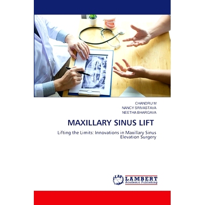 预订 Maxillary Sinus Lift: 9786207641260
