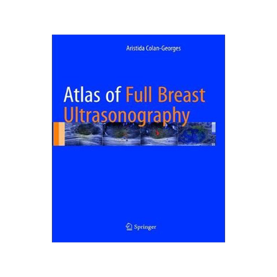 预订 Atlas of Full Breast Ultrasonography