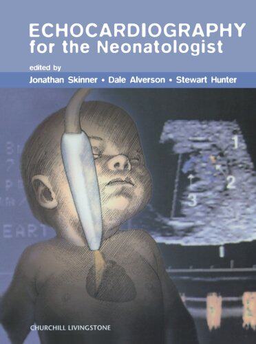 【预订】Echocardiography for the Neonatologist