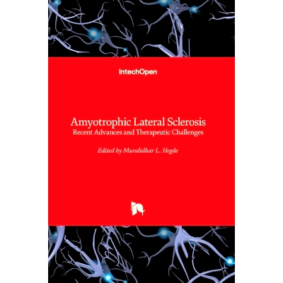 预订 Amyotrophic Lateral Sclerosis - Recent Advances and Therapeutic Challenges 肌萎缩性侧索硬化症-*进展和治疗挑战: 9781