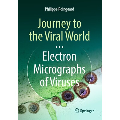 Electron Micrographs of Viruses