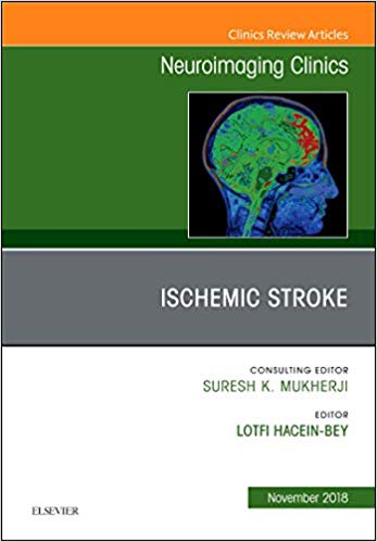 【预售】Ischemic Stroke, An Issue of Neuroimaging Clinics of North America 书籍/杂志/报纸 原版其它 原图主图