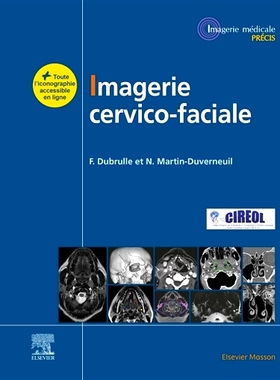 预订 Imagerie Cervicofaciale: Massif Facial - Sinus - Voies Aérodigestives Supérieures - Pathologies Cervicales - Espa
