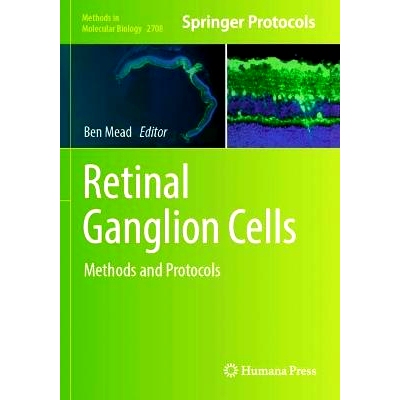 预订 Retinal Ganglion Cells: Methods and Protocols 视网膜神经节细胞：方法与协议: 9781071634110