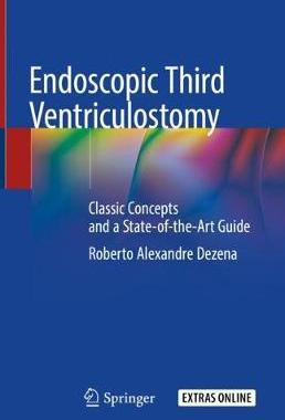 预订 Endoscopic Third Ventriculostomy