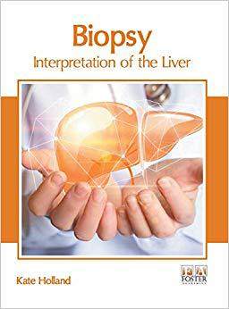 【预售】biopsy: interpretation of the liver