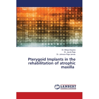 预订 Pterygoid Implants in the rehabilitation of atrophic maxilla: 9786208456832