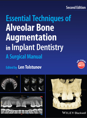 【预订】Essential Techniques Of Alveolar Bone Augmentation In Implant Dentis 9781119827320