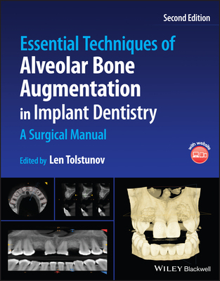 【预订】Essential Techniques Of Alveolar Bone Augmentation In Implant Dentis 9781119827320