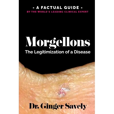 预订 Morgellons: The legitimization of a disease: A Factual Guide by the World’s Leading Clinical Expert: 9780997920024