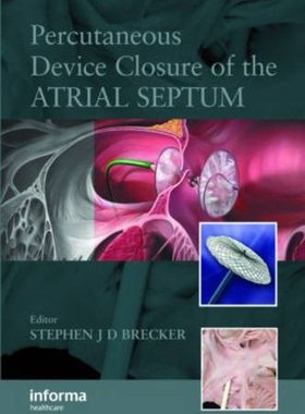 【预订】Percutaneous Device Closure of the Atrial Septum