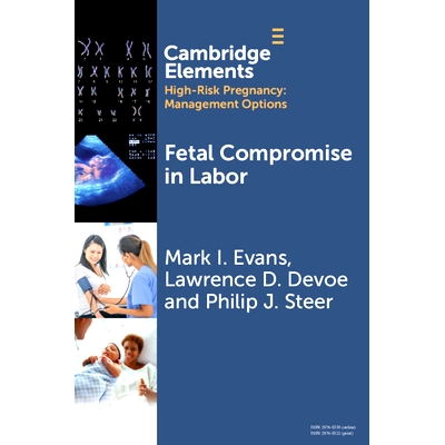 预订 Fetal Compromise in Labor 分娩时胎儿妥协: 9781009466301