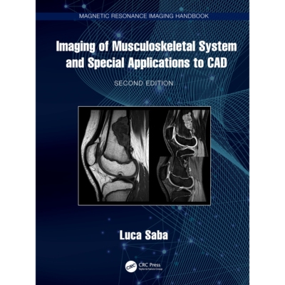 预订 Imaging of Musculoskeletal System and Special Applications to CAD 9781032123653