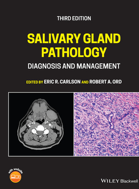 【预订】Salivary Gland Pathology - Diagnosis And Management 9781119730187
