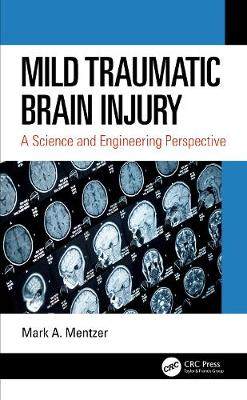 【预订】Mild Traumatic Brain Injury