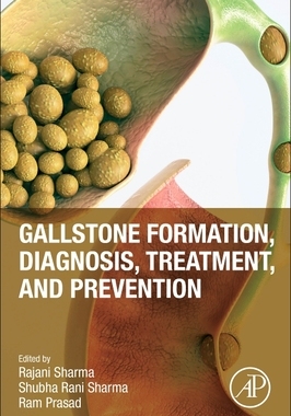 预订 Gallstone Formation, Diagnosis, Treatment and Prevention