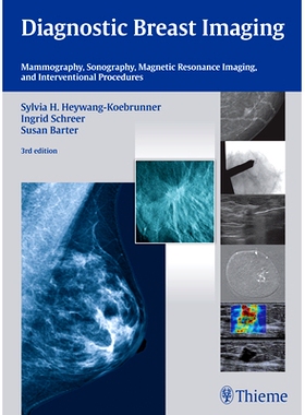 预订 Diagnostic Breast Imaging: Mammography, Sonography, MRI and Interventional Procedures 诊断性乳腺成像: 9783132431928