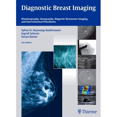 预订 Diagnostic Breast Imaging: Mammography, Sonography, MRI and Interventional Procedures 诊断性乳腺成像: 9783132431928