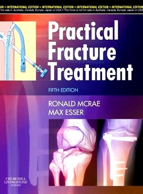 预订 Practical Fracture Treatment, International Edition: 9780443068775