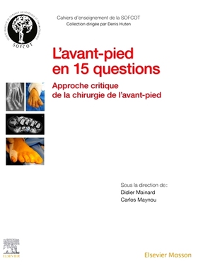 预订 L’avant-pied en 15 questions : approche critique de la chirurgie de l’avant-pied 前足的 15 个问题：前足手术的关键